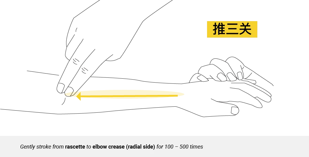 Teaching diagram of Tui San Guan stroke on the radial forearm