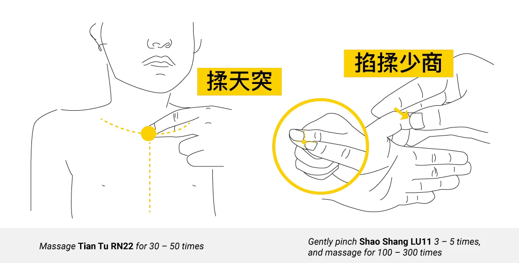 Teaching diagram of Tian Tu RN22 and Shao Shang LU11 paediatric points