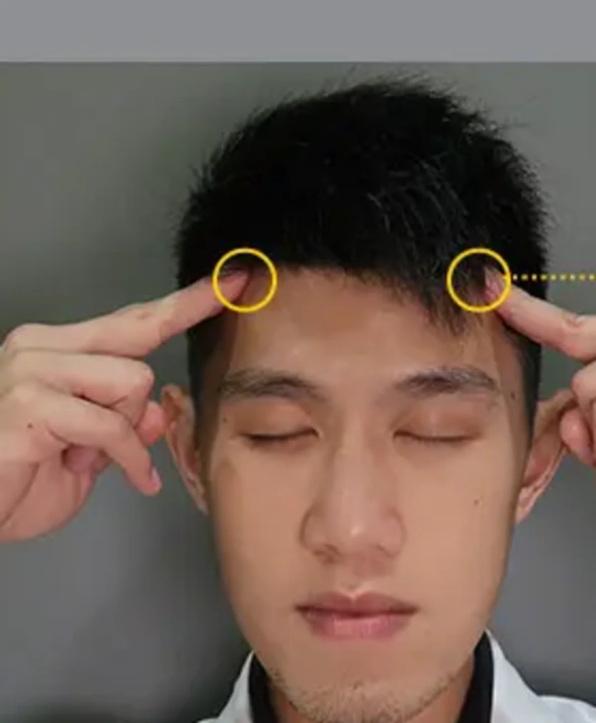 Fingers locating Tou Wei ST8 at the forehead hairline corners