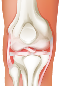 Knee tendons and ligaments in an anterior joint diagram