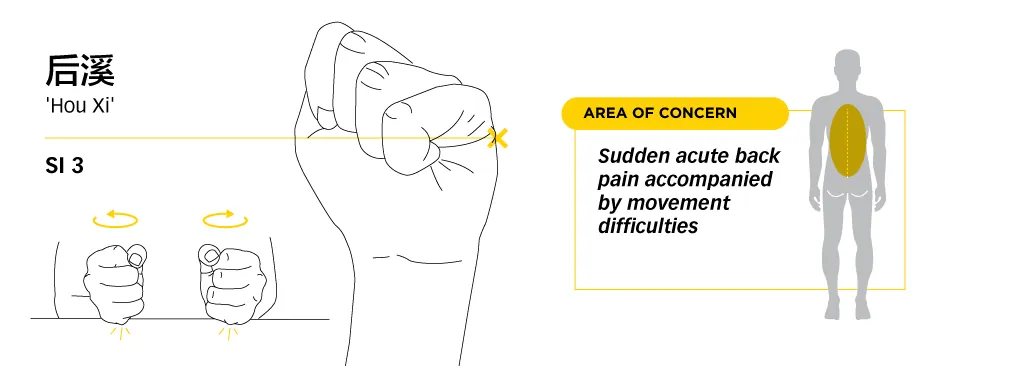 Line diagram locating Houxi SI3 on the ulnar side of the hand