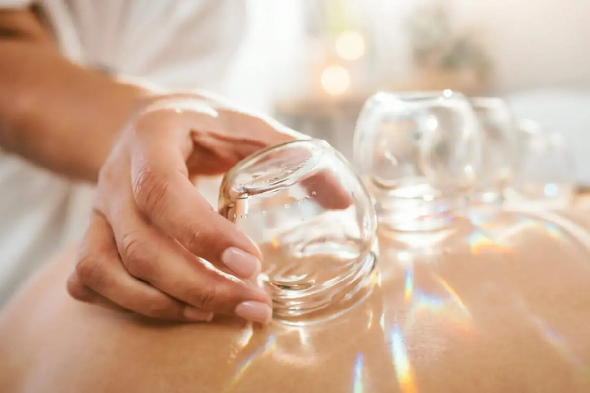 Cupping therapy used when dampness patterns feature at PULSE TCM