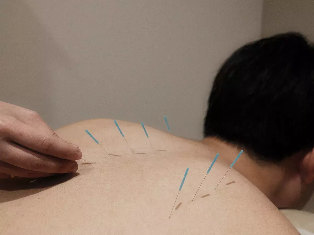 TCM treatment room at a PULSE clinic