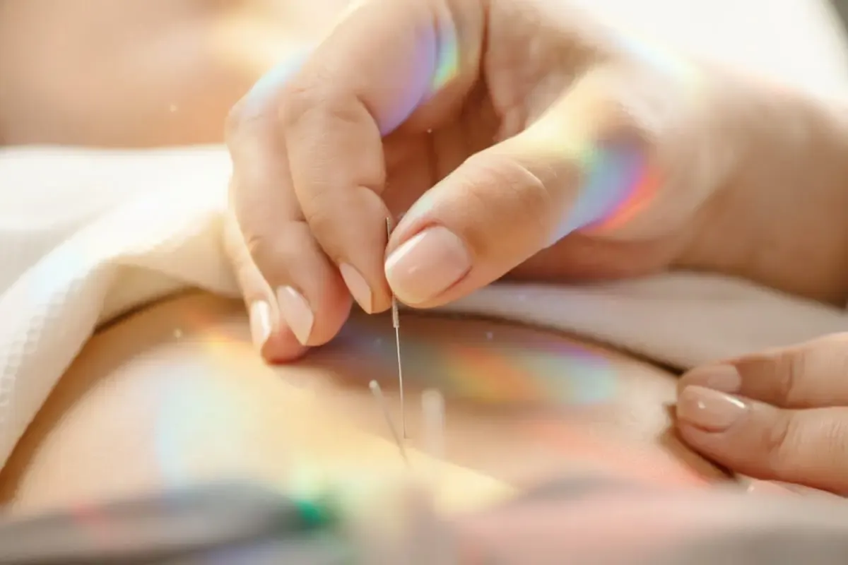 Physician preparing acupuncture care at PULSE TCM