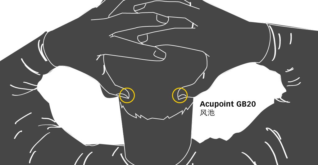 GD20 Acupressure point for Migraine