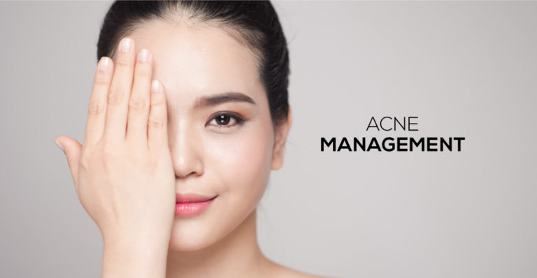 Acne Management Singapore