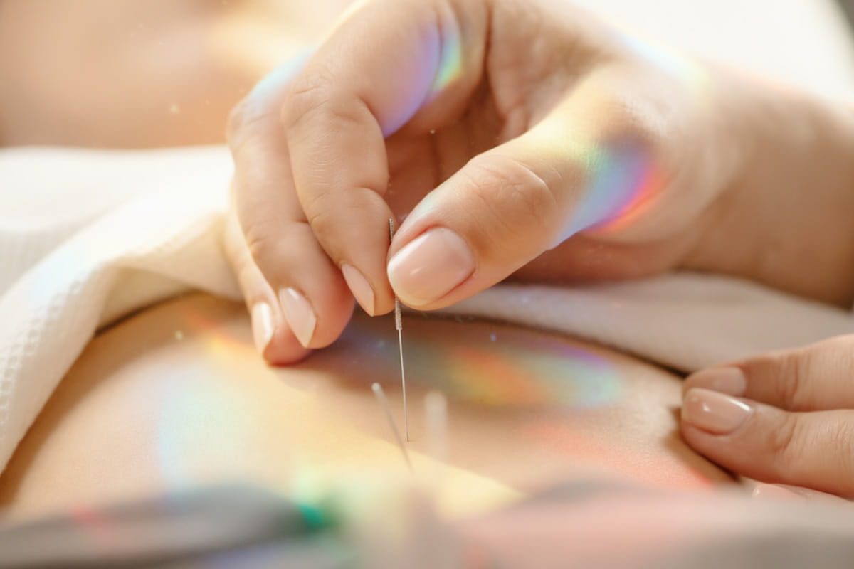 PULSE TCM Acupuncture Treatment