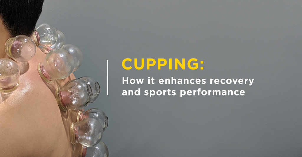 Cupping_How_it_enhances_recovery_and_sports_performance_1