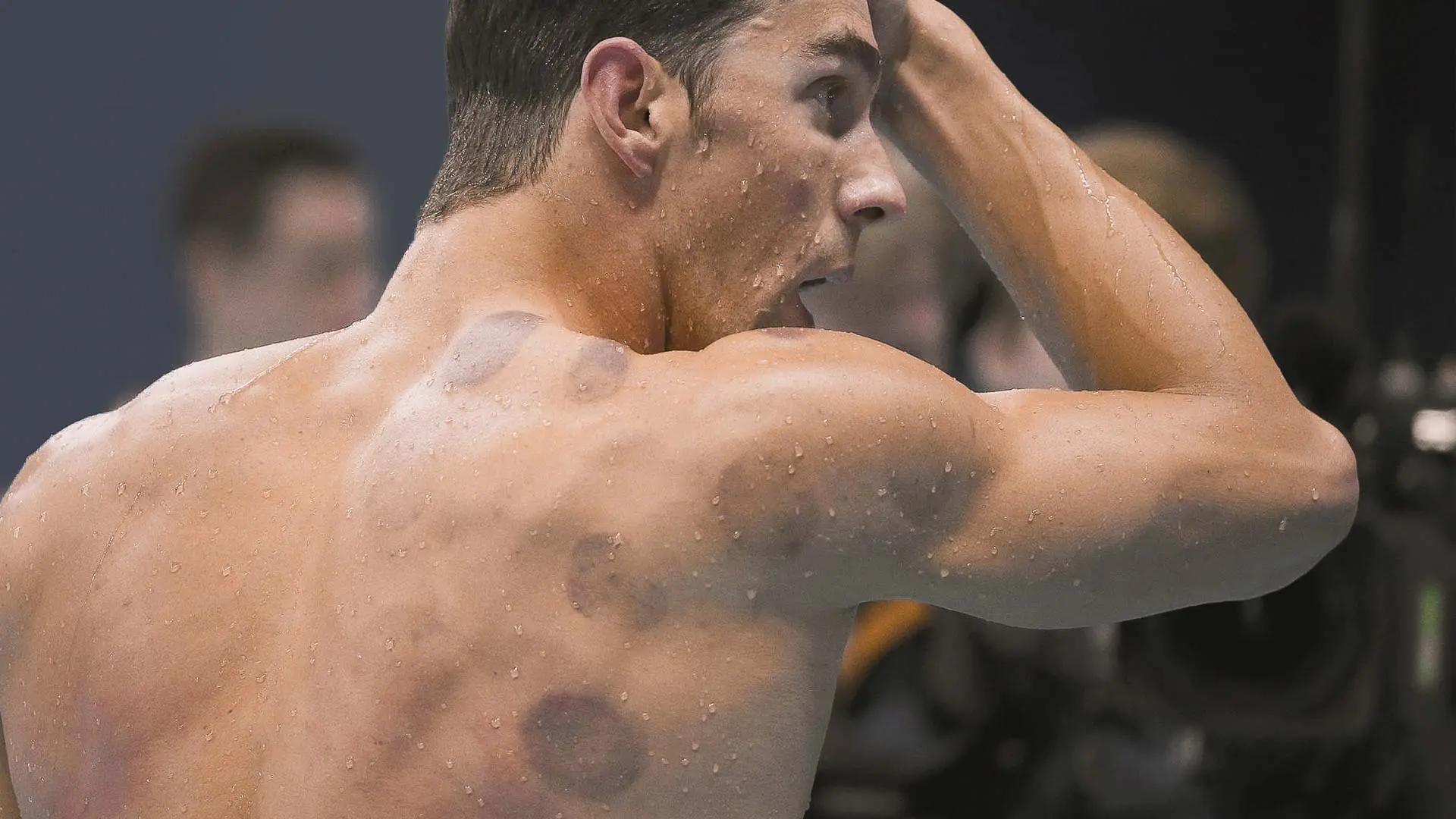 michael phelps with cupping marks on his back
